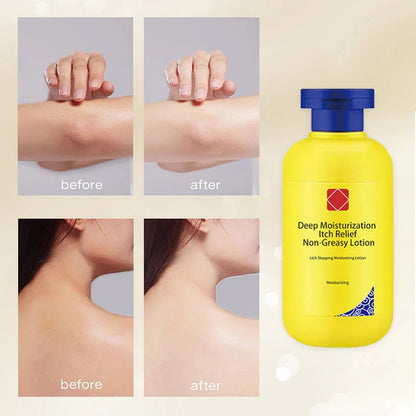 🔥Winter promotion 49% OFF🔥Deep moisturizing itch relief Non-greasy lotion❄️ ☃️ | 🔥Buy 1 Get 1 Free🔥